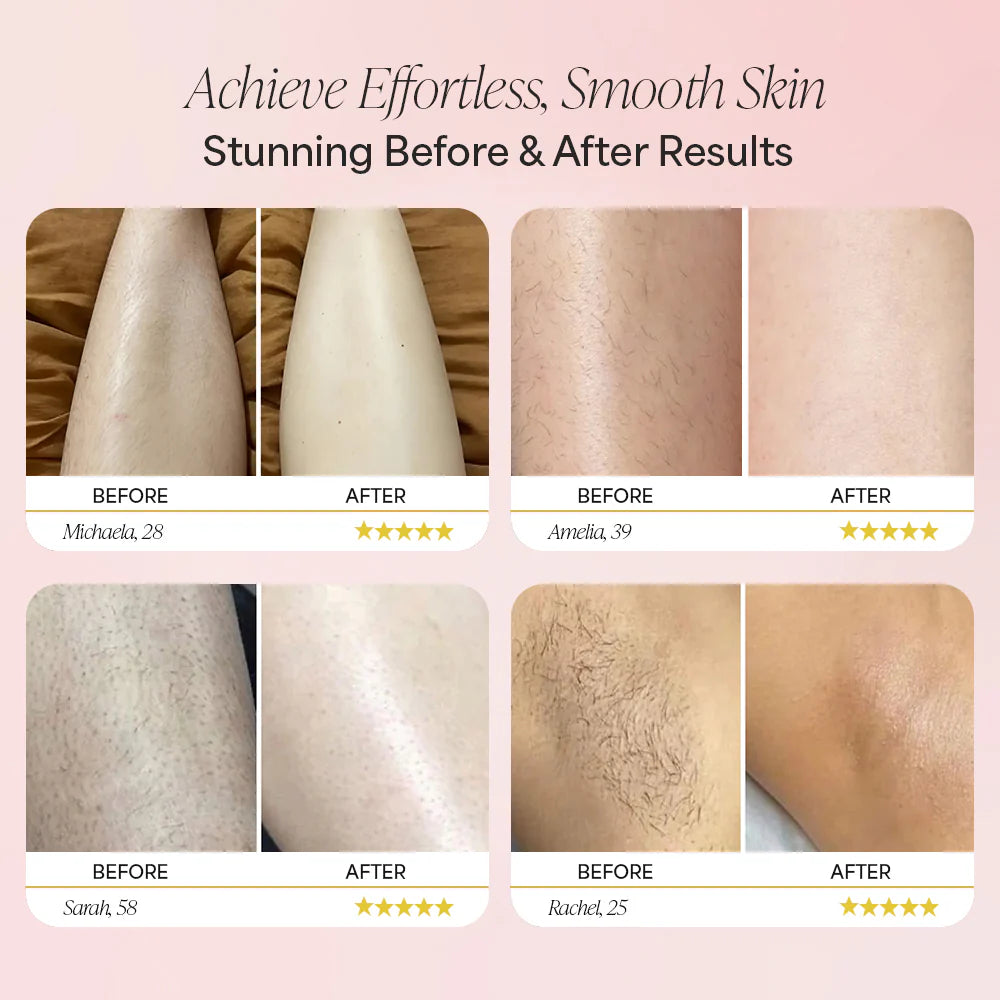 1TK Dermave™ Trimmer 2.0