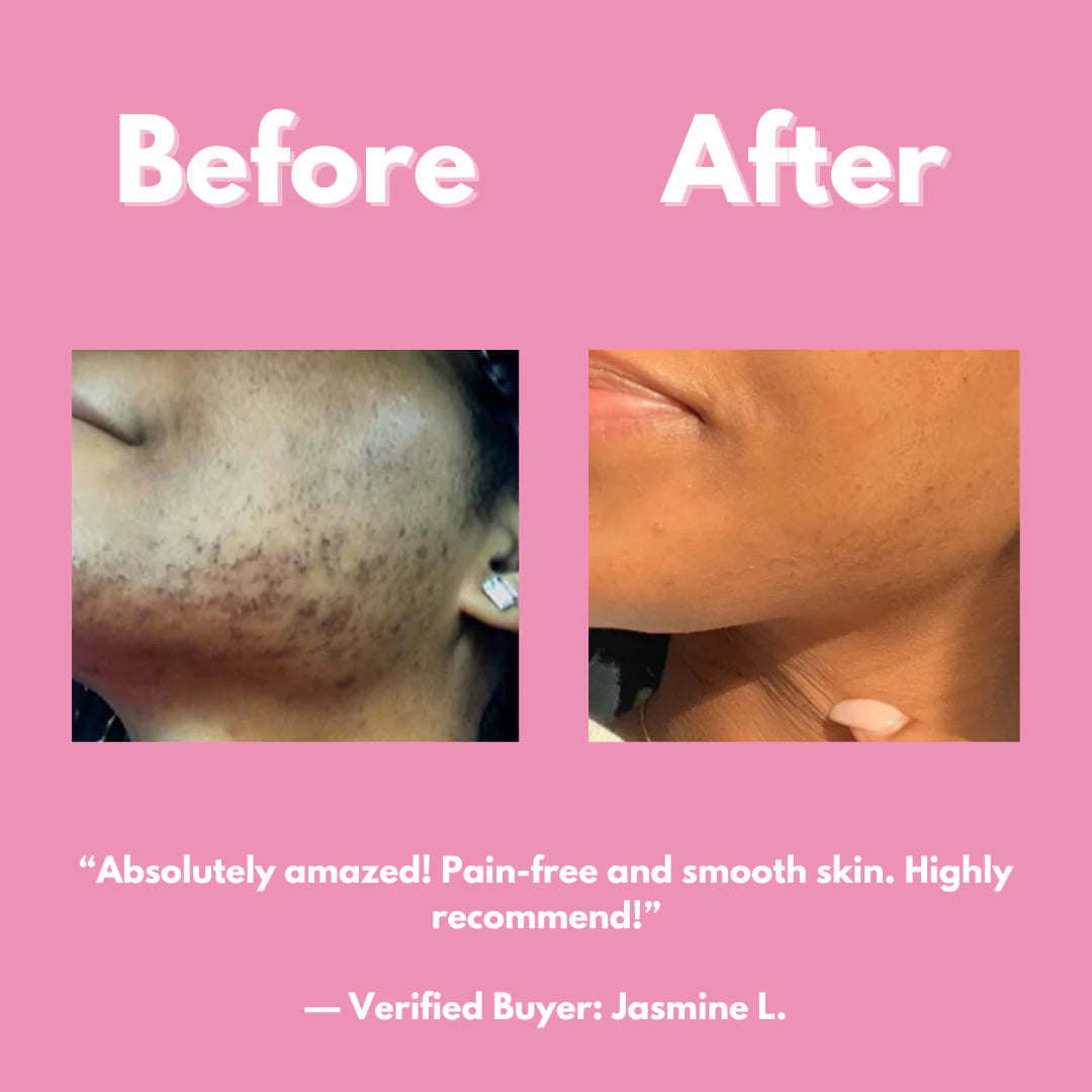 🇰🇪 TK4 Multi Cosmetics™ Smooth & Shine Hair Removal Kit