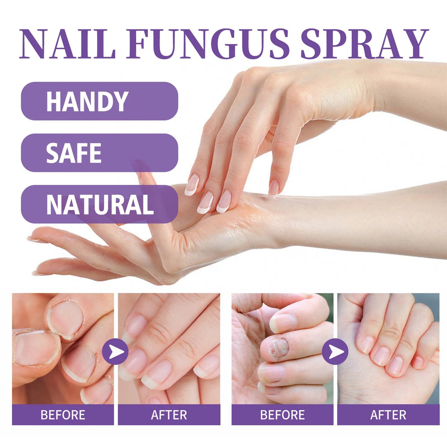 New Advanced Foot and Nail Spray