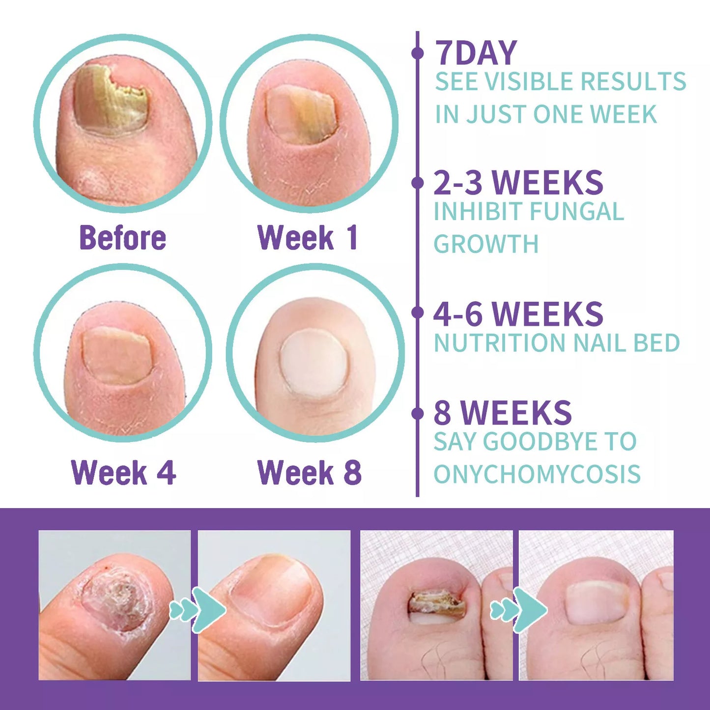New Advanced Foot and Nail Spray