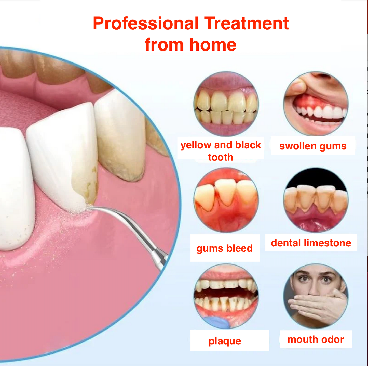 SP Dental Scaler