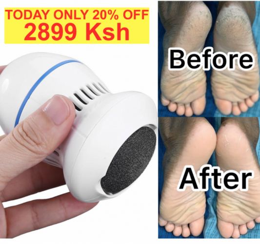 The NEW Rechargeable Electric Vacuum Foot Cleaner 20% OFF