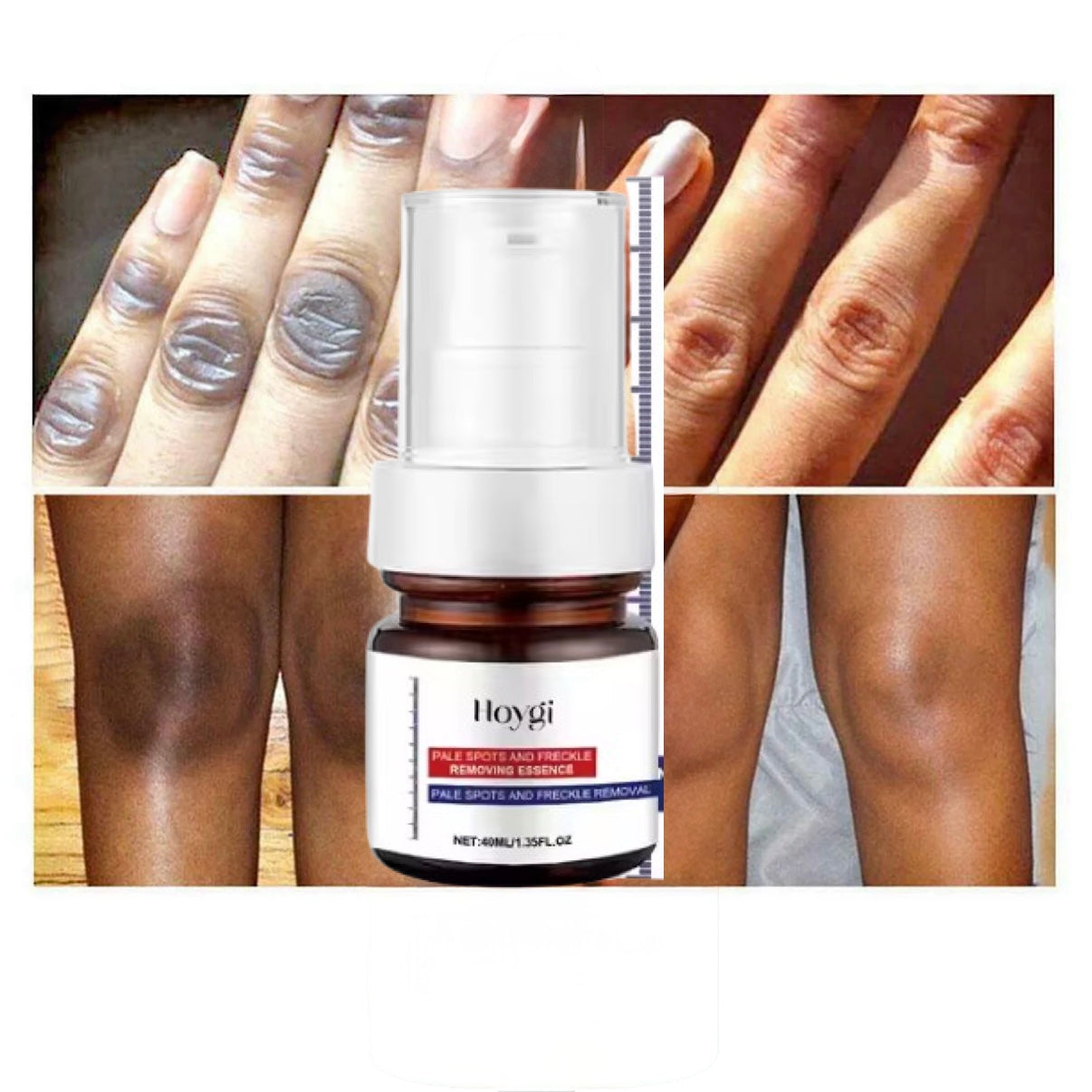 Hoygi Whitening Skin Serum