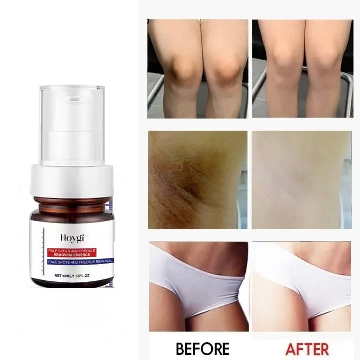 Hoygi Whitening Skin Serum