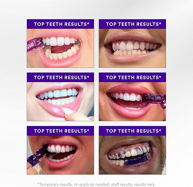 V34 Whitening Strips, Teeth Whitening Strips